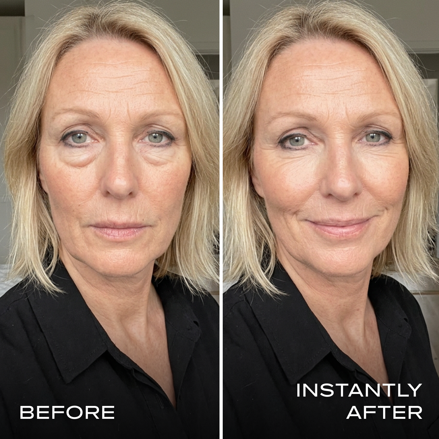 Instant Eye Tightener