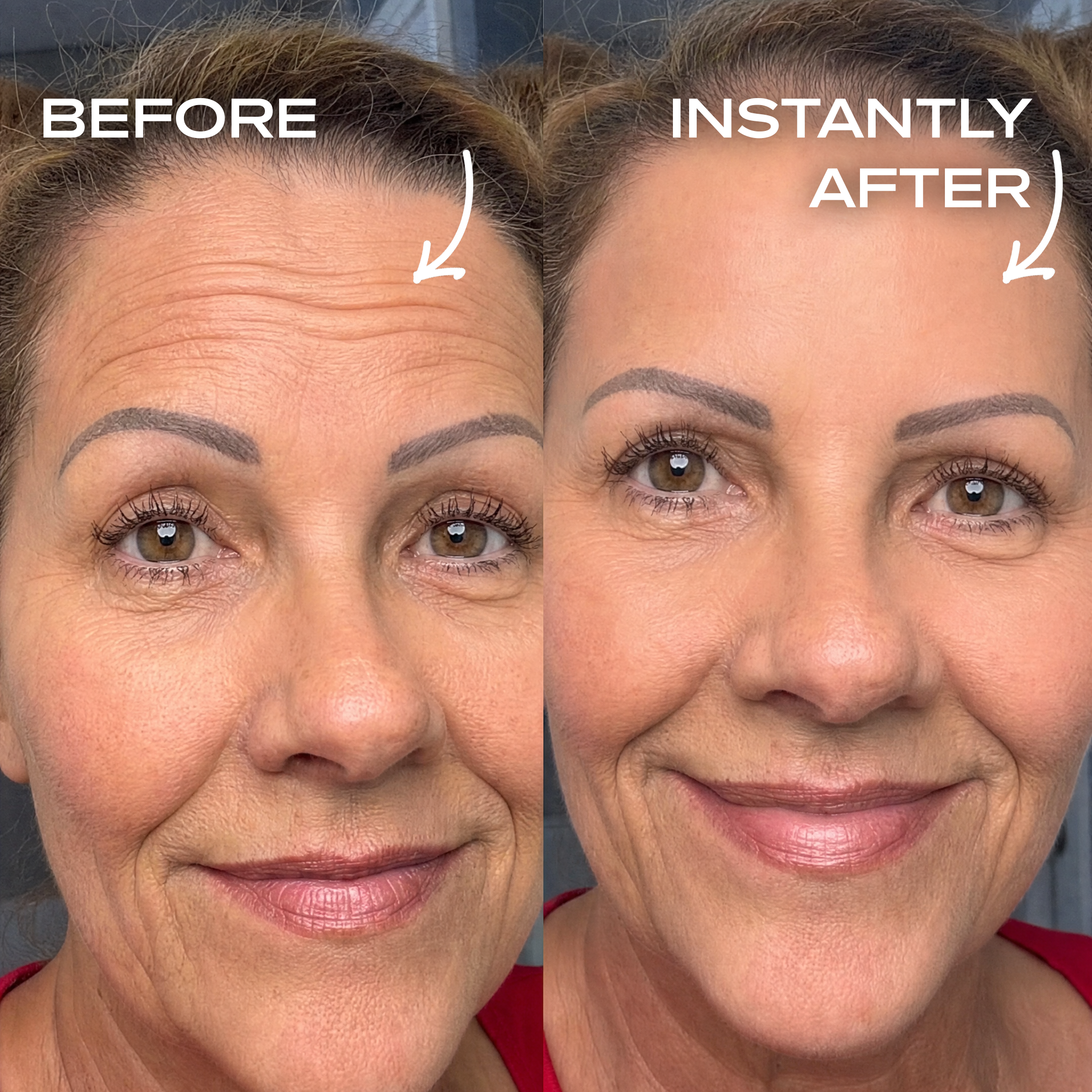 Instant Wrinkle Filler
