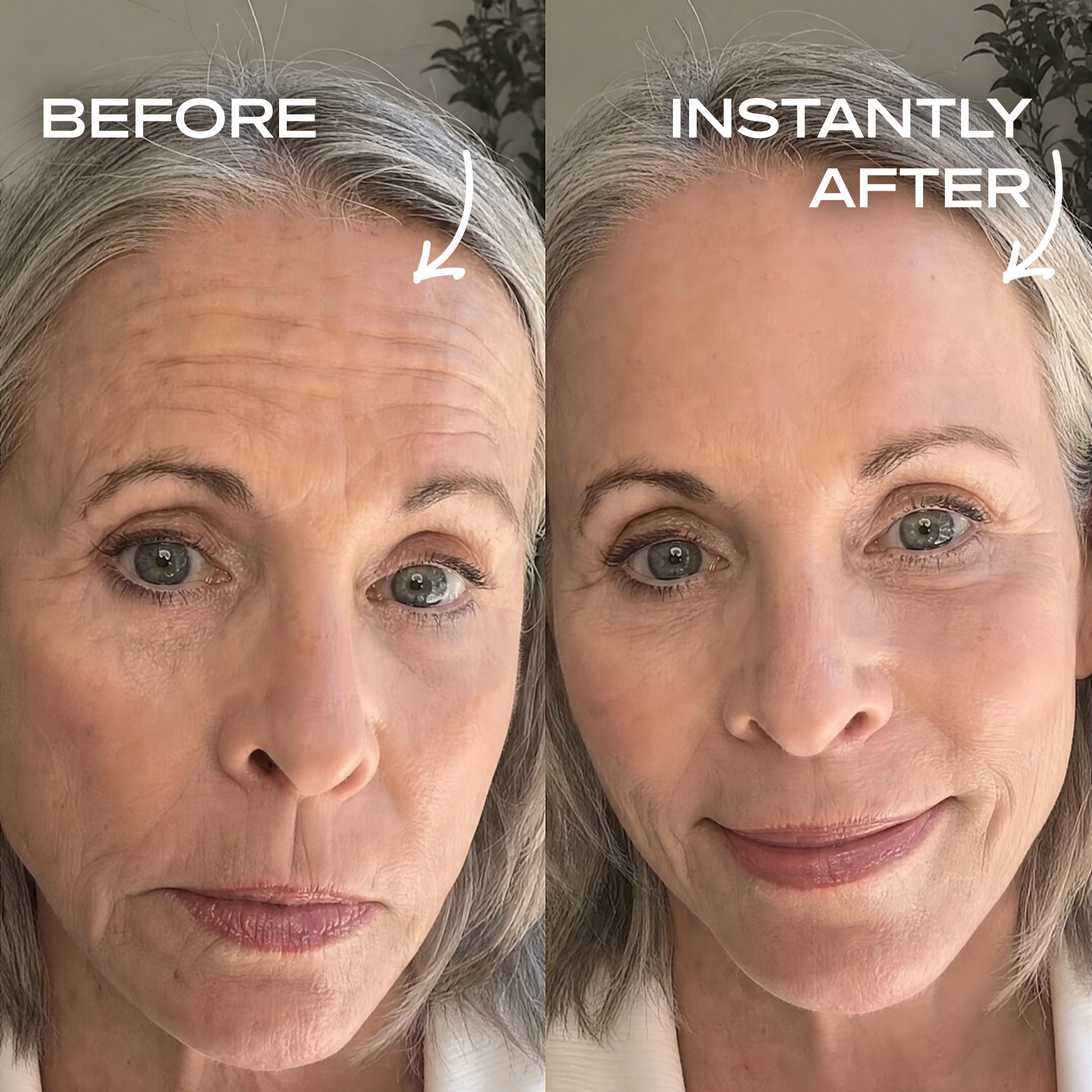 Instant Wrinkle Filler