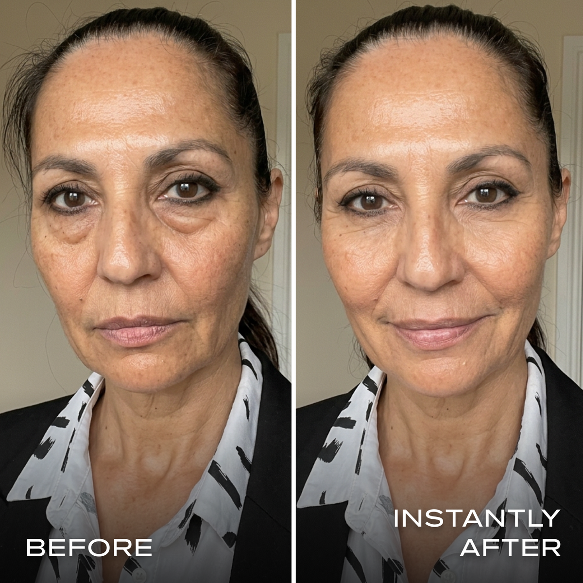 Instant Eye Tightener
