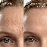 Instant Wrinkle Filler