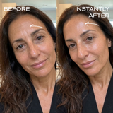 Instant Wrinkle Filler