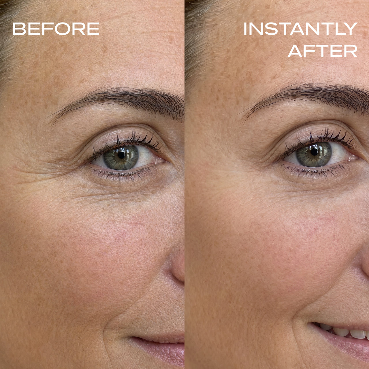 Instant Wrinkle Filler