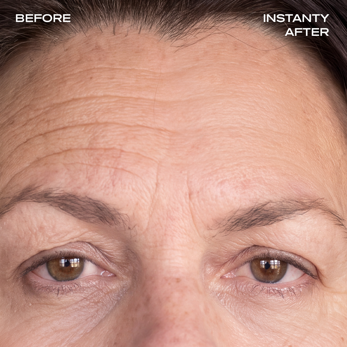 Instant Wrinkle Filler
