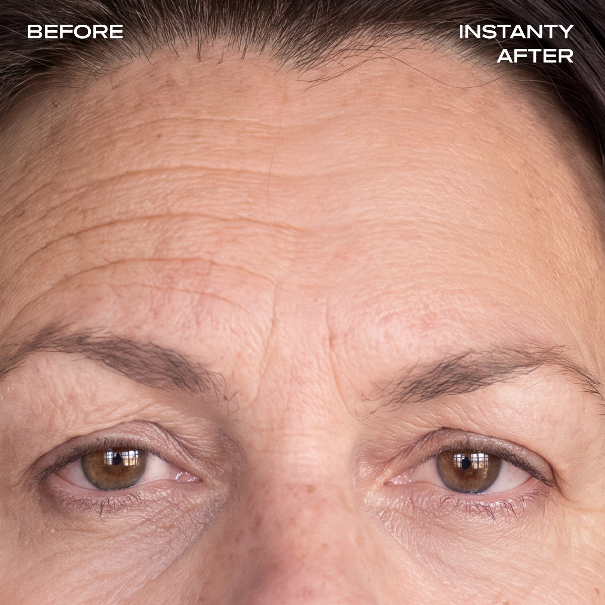 Instant Wrinkle Filler