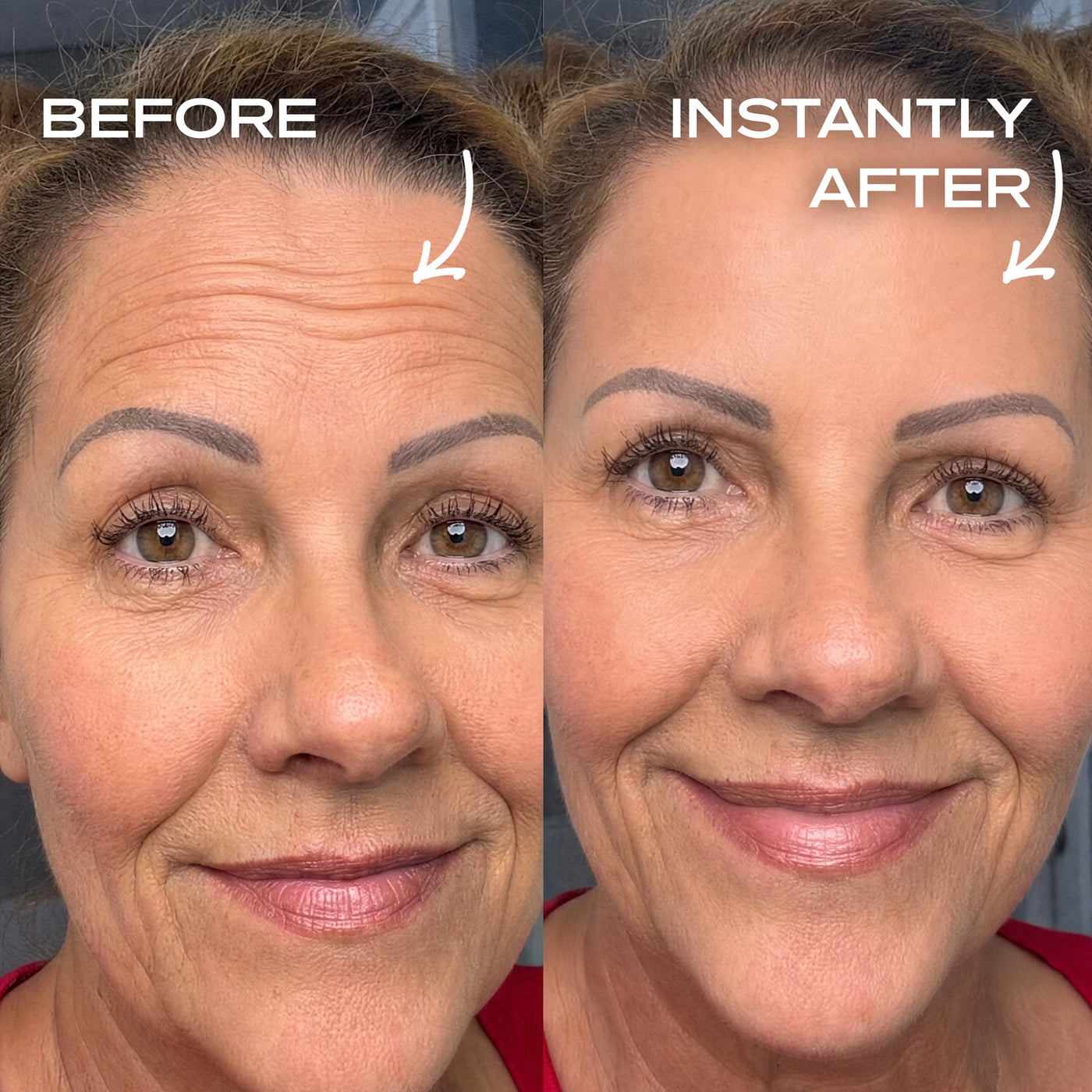 Instant Wrinkle Filler
