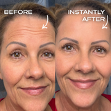 Instant Wrinkle Filler
