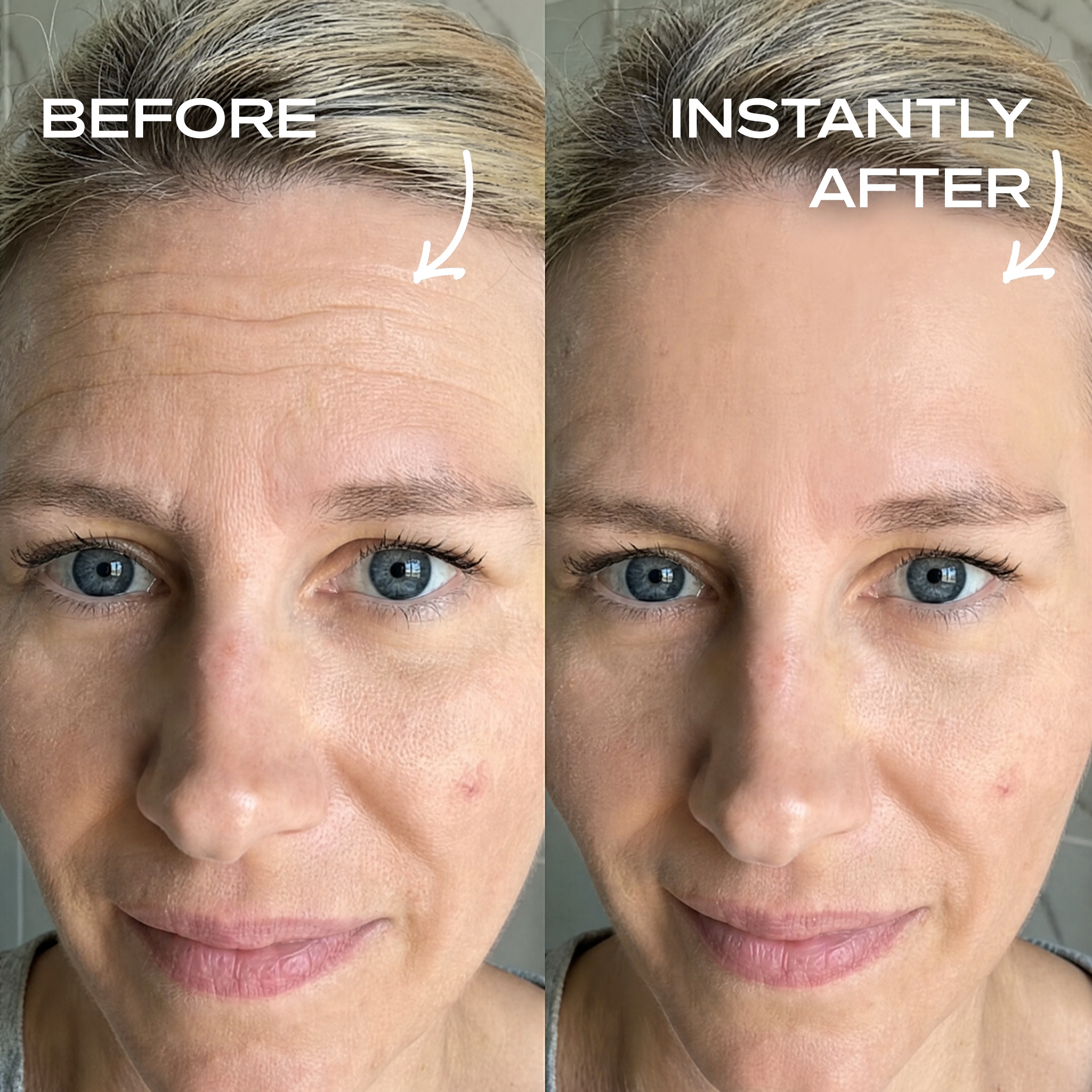 Instant Wrinkle Filler