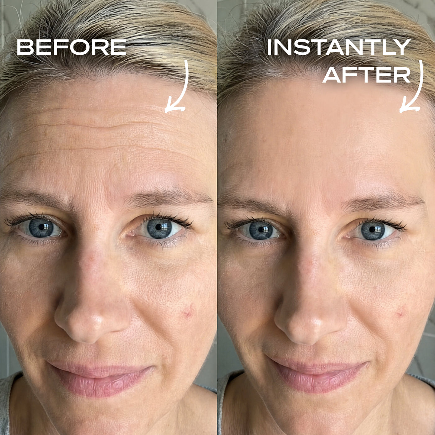 Instant Wrinkle Filler
