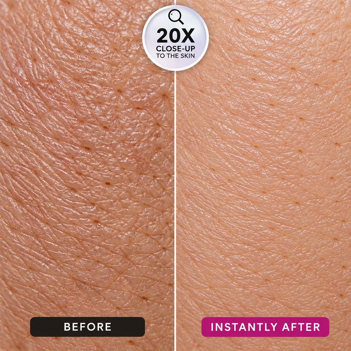 Instant Wrinkle Filler