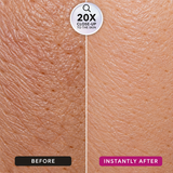 Instant Wrinkle Filler