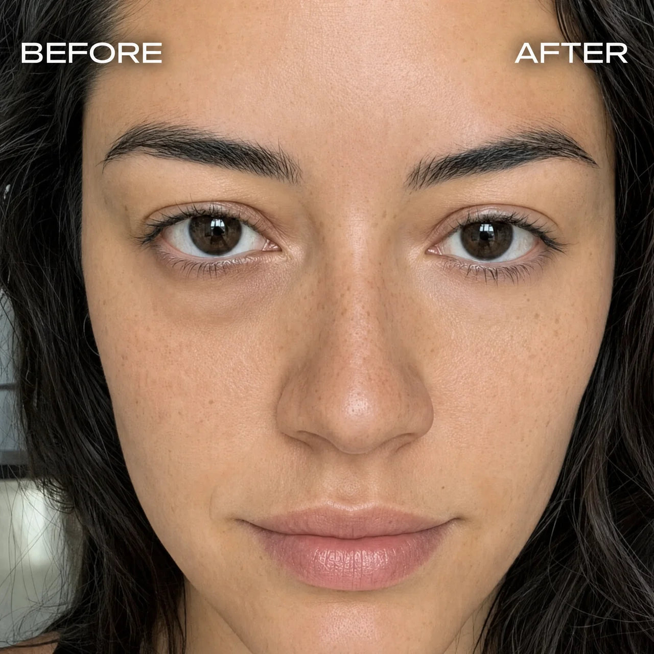 Instant Dark Circles Remover