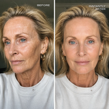 Instant Wrinkle Filler